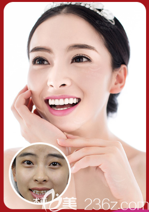 遵義利美康牙齒矯正