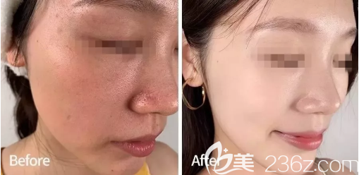 干燥油膩與水嫩白皙皮膚的對(duì)比