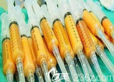 體脂肪填充面部到底可以維持多久？