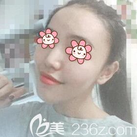 做自體脂肪填充額頭術(shù)后9天恢復(fù)<span style= 做自體脂肪填充額頭術(shù)后9天恢復(fù)<span style=