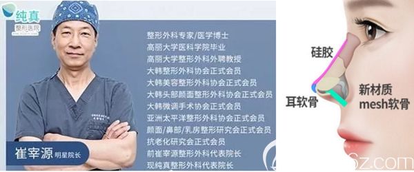 韓國純真整形外科崔宰源隆鼻手術(shù) 韓國純真整形外科崔宰源隆鼻手術(shù)