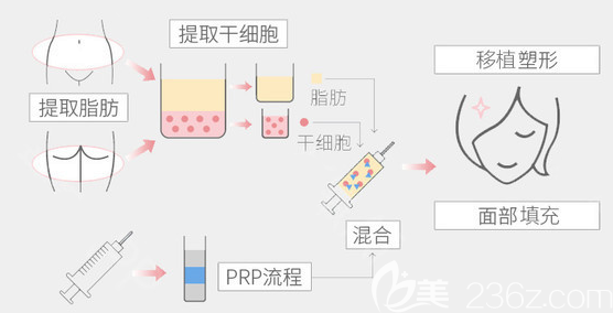 整形醫(yī)院面部脂肪填充原理圖