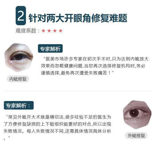 開眼角失敗修復(fù)解析