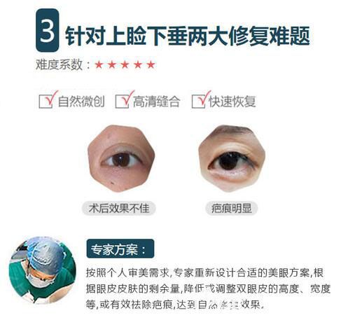 上瞼下垂、疤痕明顯修復(fù)方案