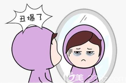 玻尿酸去黑眼圈效果維持多久呢？