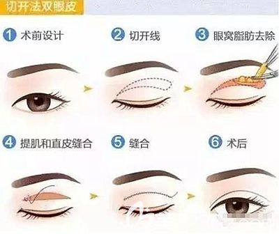 信陽易韓安和擅長項目：全切雙眼皮