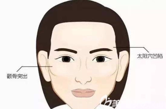 高顴骨的女人一般都有太陽穴凹陷的癥狀