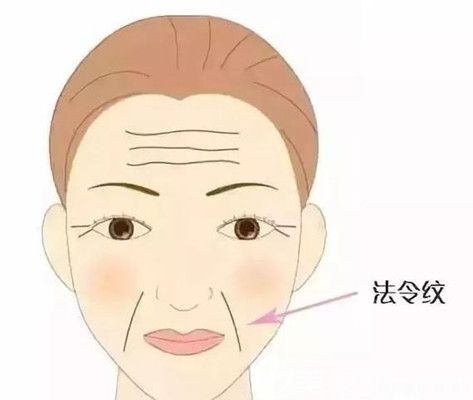 法令紋體現(xiàn)女性衰老的特征