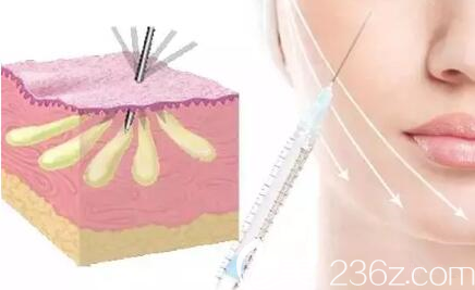 脂肪提純后注射進(jìn)入面部