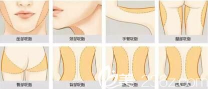 全身脂肪存在較多的部位