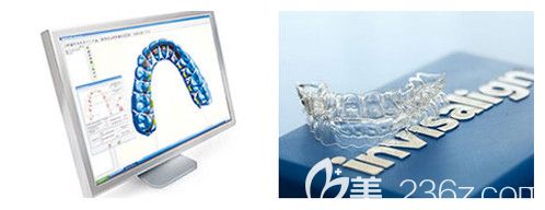 上饒維樂陽光口腔正畸口掃儀 上饒維樂陽光口腔正畸口掃儀