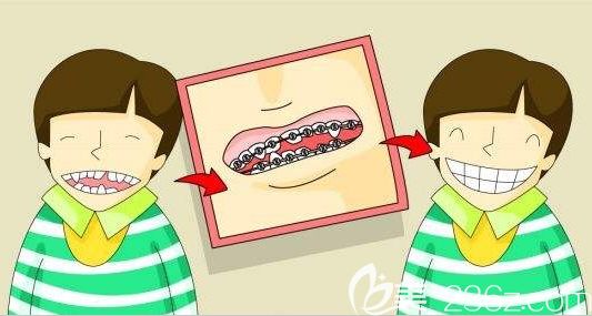 任茹冰醫(yī)師科普兒童牙齒矯正的方法 任茹冰醫(yī)師科普兒童牙齒矯正的方法