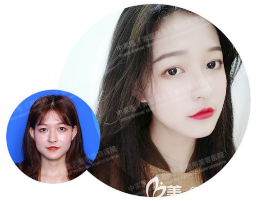 廣州中家醫(yī)家庭醫(yī)生朱云醫(yī)生提升