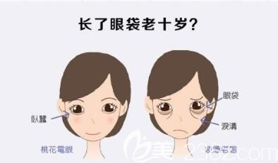 內(nèi)切去眼袋多錢？