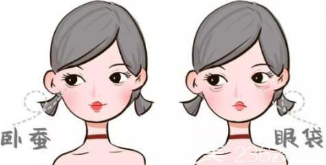 外切去眼袋的效果