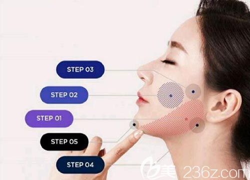 韓國美迪瑩吸脂優(yōu)勢