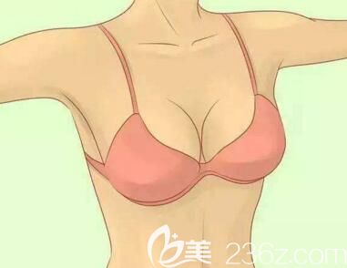 做自體脂肪豐胸后多久可以進(jìn)行二次填充？