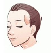 太陽(yáng)穴凹陷示意圖