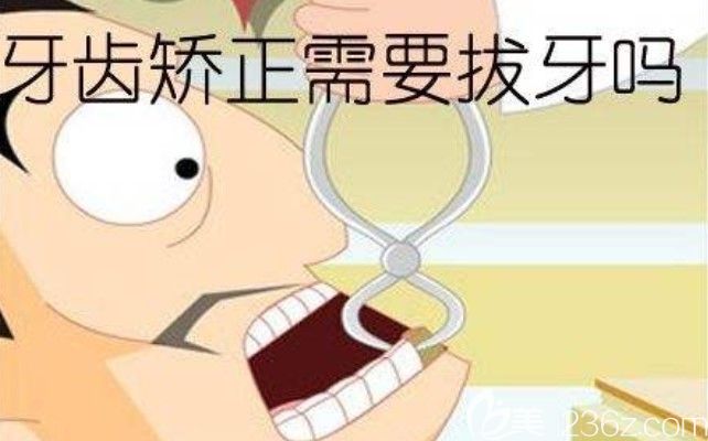 陳聰慧醫(yī)生講解整牙需要拔牙嗎