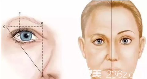 易韓整形提眉術(shù)可以顯示面部年輕