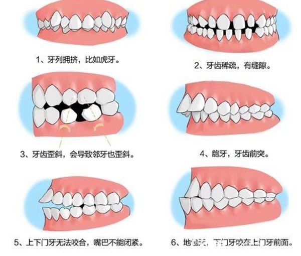哪些牙齒需要矯正 哪些牙齒需要矯正