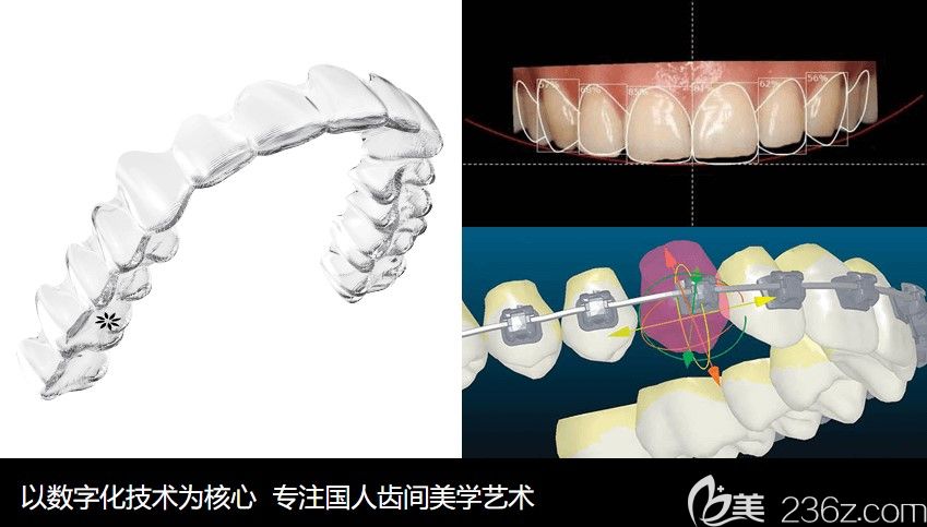 北京海德堡聯(lián)合口腔正畸過程中實施全程監(jiān)控 北京海德堡聯(lián)合口腔正畸過程中實施全程監(jiān)控