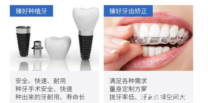 杭州臻好特色項(xiàng)目介紹圖 杭州臻好特色項(xiàng)目介紹圖