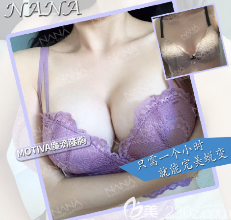 有沒有韓國NANA整形外科魔滴隆胸案例