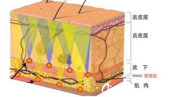 小切口除皺術(shù)的危害介紹