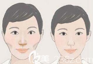 韓國做輪廓顴骨整形醫(yī)院哪家好？