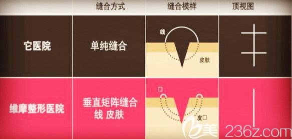 切口創(chuàng)傷微小化