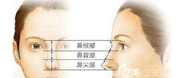 美麗焦點焦俊光做隆鼻手術(shù)貴不