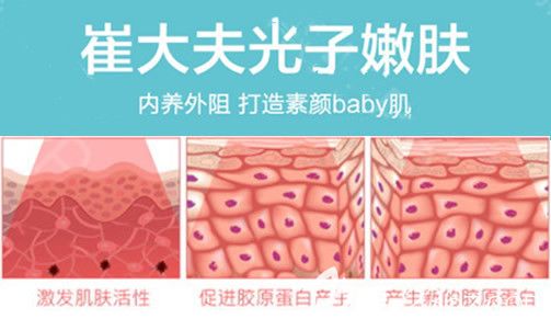 崔大夫IPL光子嫩膚作用