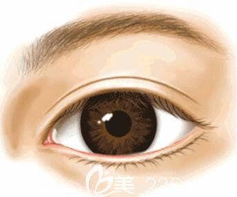 韓國做埋線雙眼皮哪家醫(yī)院好？