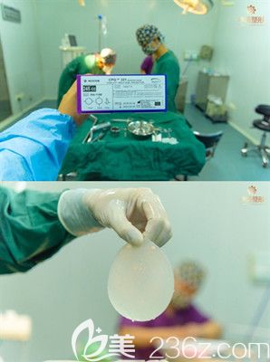 洛陽華美整形曼托假體隆胸手術