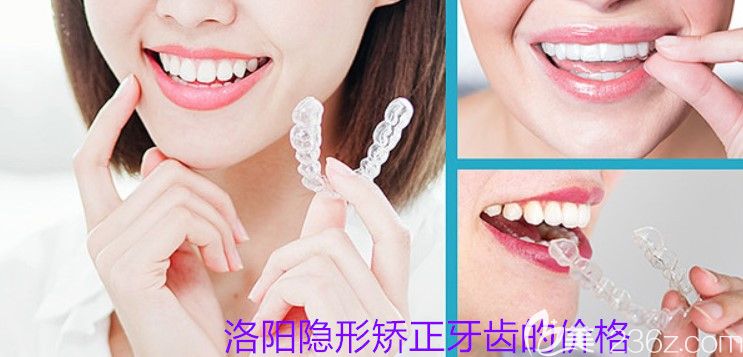 洛陽隱形矯正牙齒多少錢？牙大夫口腔正雅隱形牙套價(jià)格2萬起
