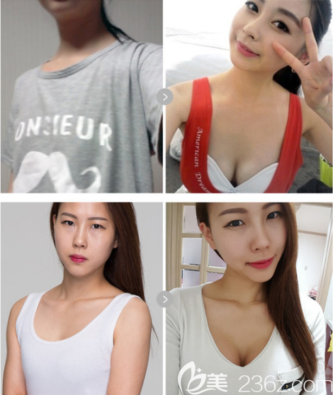 韓國歐佩拉除了輪廓好還有什么