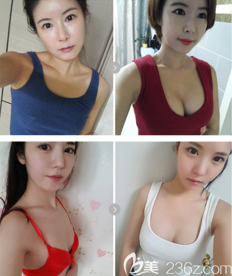 韓國歐佩拉整形外科怎么樣