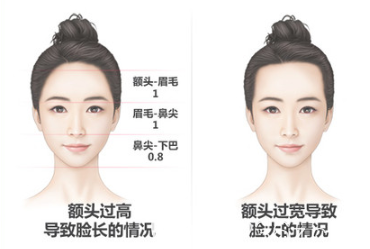韓國毛杰琳整形醫(yī)院額頭縮小 韓國毛杰琳整形醫(yī)院額頭縮小
