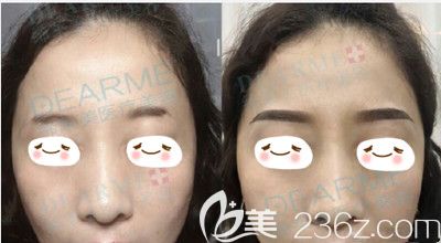 周口締萊美紋眉前后的效果對(duì)比