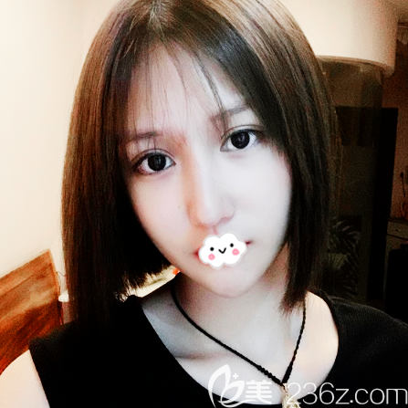 早就聽說深圳富華整形醫(yī)院金順女雙眼皮做的好親身體驗(yàn)后果然名不虛傳