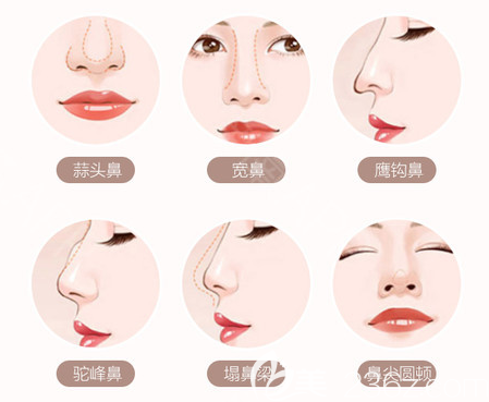 深圳<!--<i data=20240703-sp></i>-->醫(yī)院朱輝醫(yī)生隆鼻優(yōu)勢(shì)