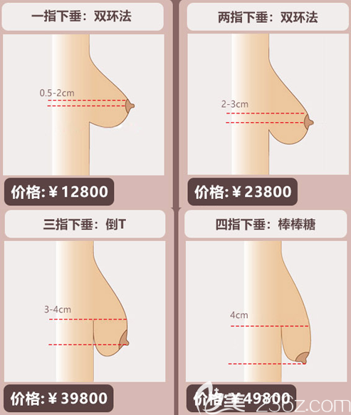 深圳南雅整形醫(yī)院胸部下垂矯正方法及價(jià)格