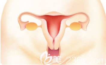 子宮示意圖