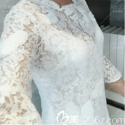 北京腰腹環(huán)吸哪家做的好？我在北京美萊做腰腹環(huán)吸第35天效果參考