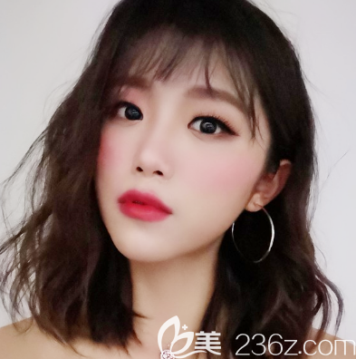 專程跑去廣州愛來整形醫(yī)院找余花主任做了自體脂肪面部填充和雙眼皮,給大家看效果好不好