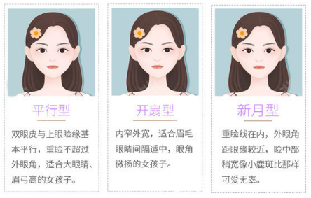深圳富華整形醫(yī)院謝福庚醫(yī)生雙眼皮手術(shù)類型