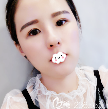 ?看網(wǎng)上評價說廣州軍美王世虎做脂肪填充技術(shù)特別好于是專程過來找他做了全臉脂肪填充