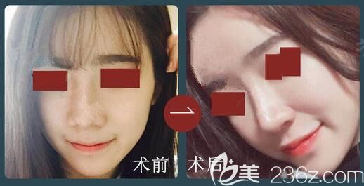 韓國(guó)鼻修復(fù)好的醫(yī)生推薦