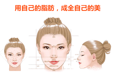 東莞韓美整形醫(yī)院曾慶明做脂肪填充優(yōu)勢(shì) 東莞韓美整形醫(yī)院曾慶明做脂肪填充優(yōu)勢(shì)